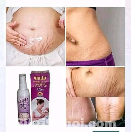 ignite mother care lotion